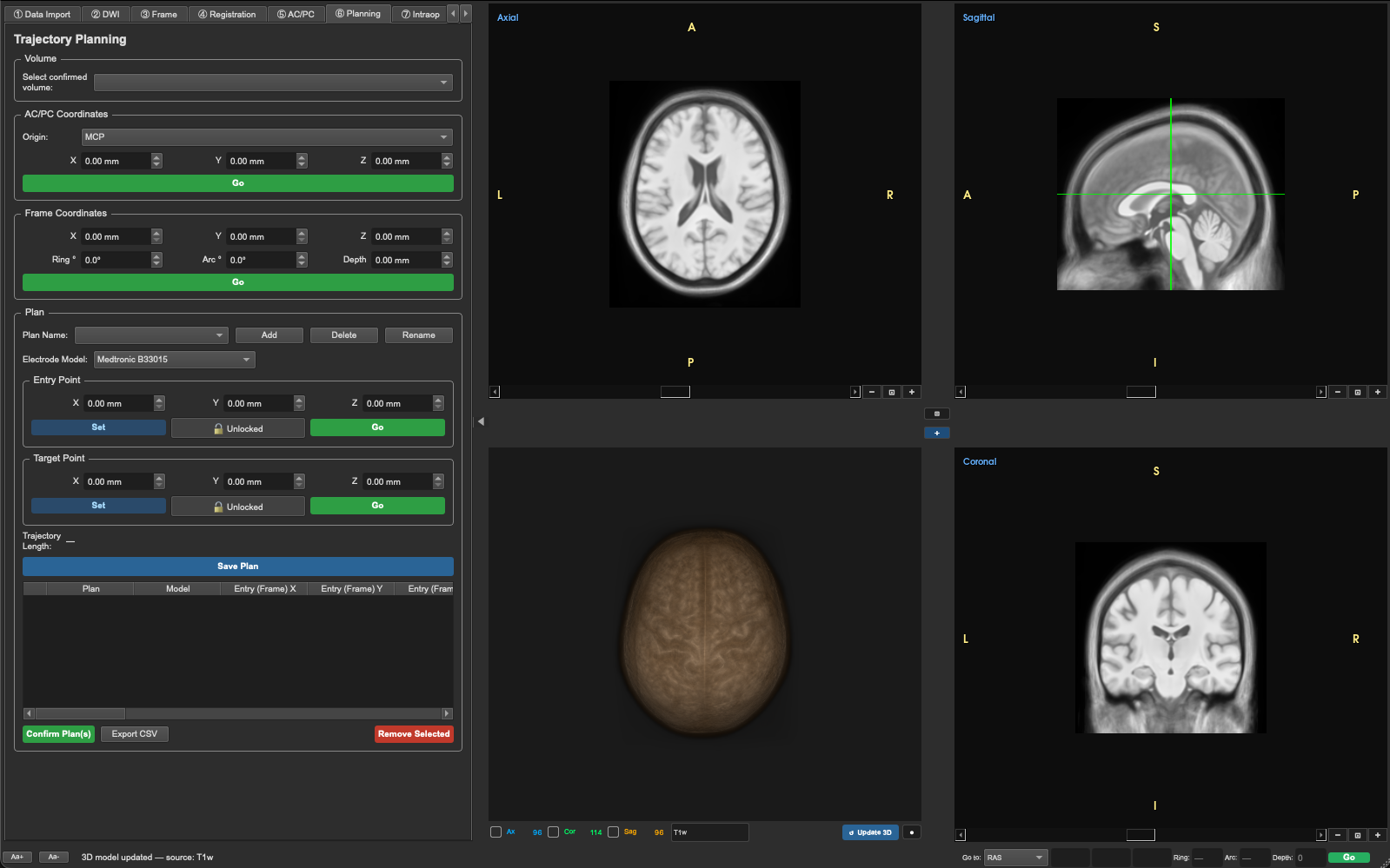 NeuroTraxx subcortical mapping view with synchronized axial, sagittal, coronal and 3D brain rendering